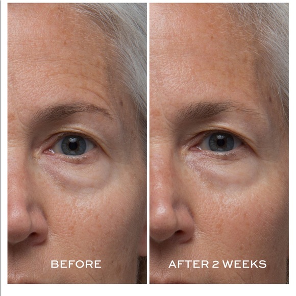 Elemis - Picture 5 of 5